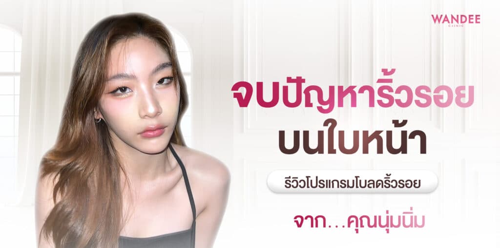 โบลดริ้วรอย คุณนุ่มนิ่ม