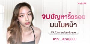 โบลดริ้วรอย คุณนุ่มนิ่ม