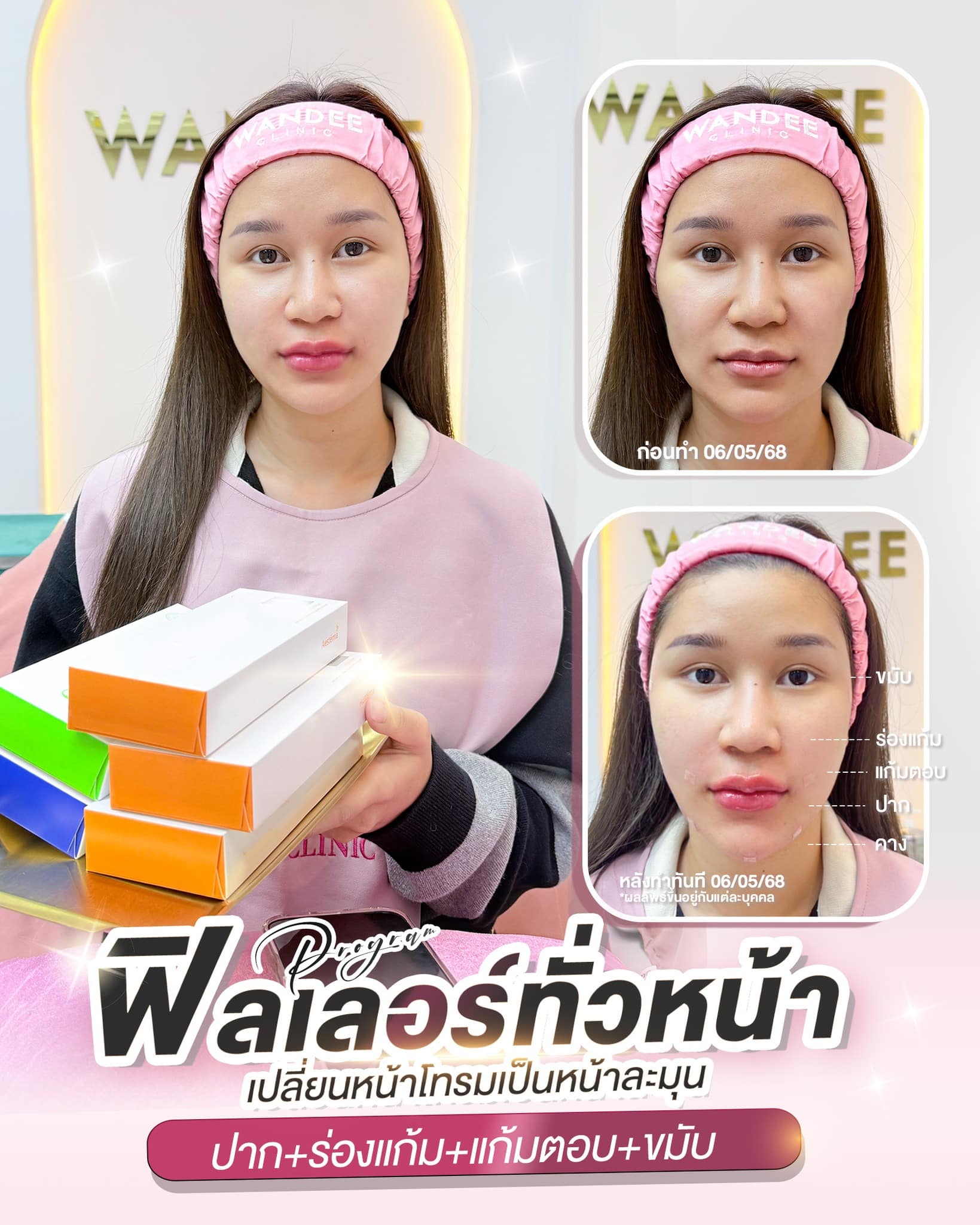 เปลี่ยนหน้าโทรมเป็นหน้าละมุน