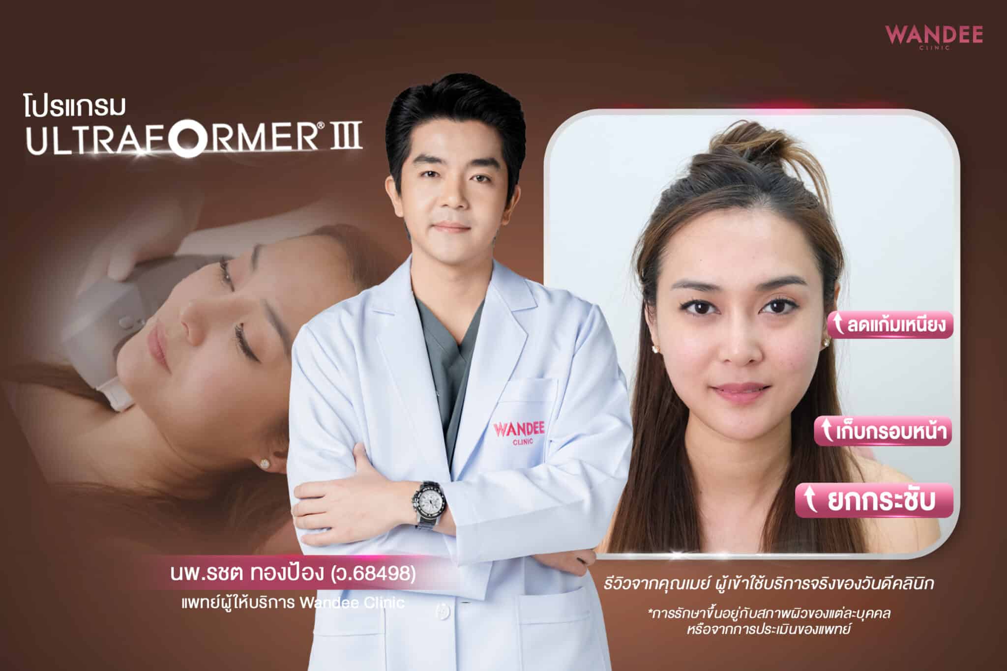 ultraformer เมย์