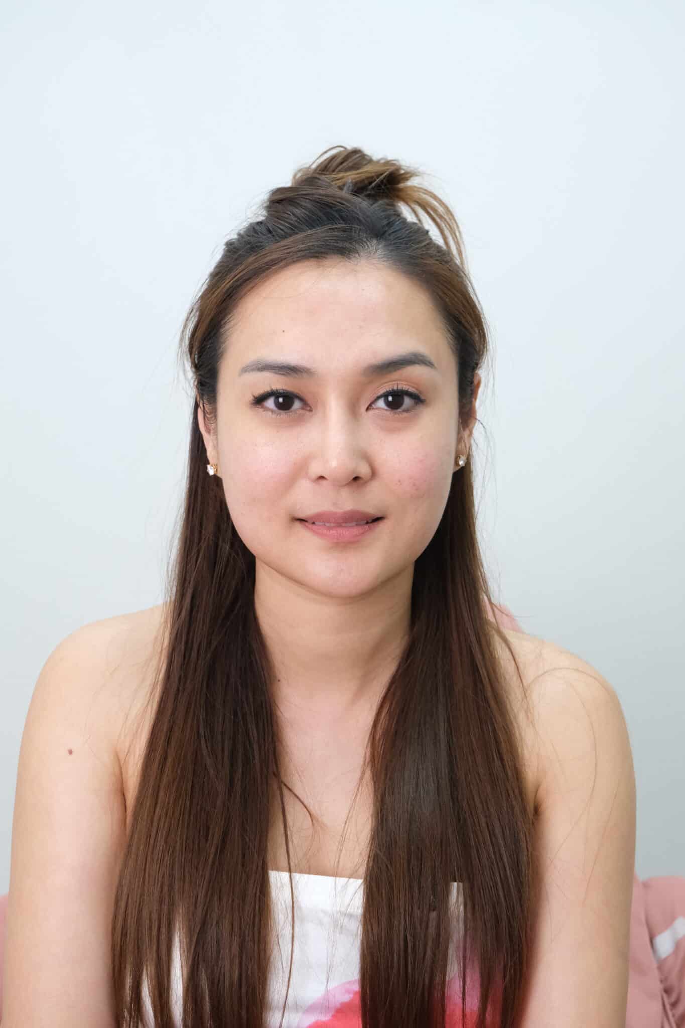 ultraformer เมย์