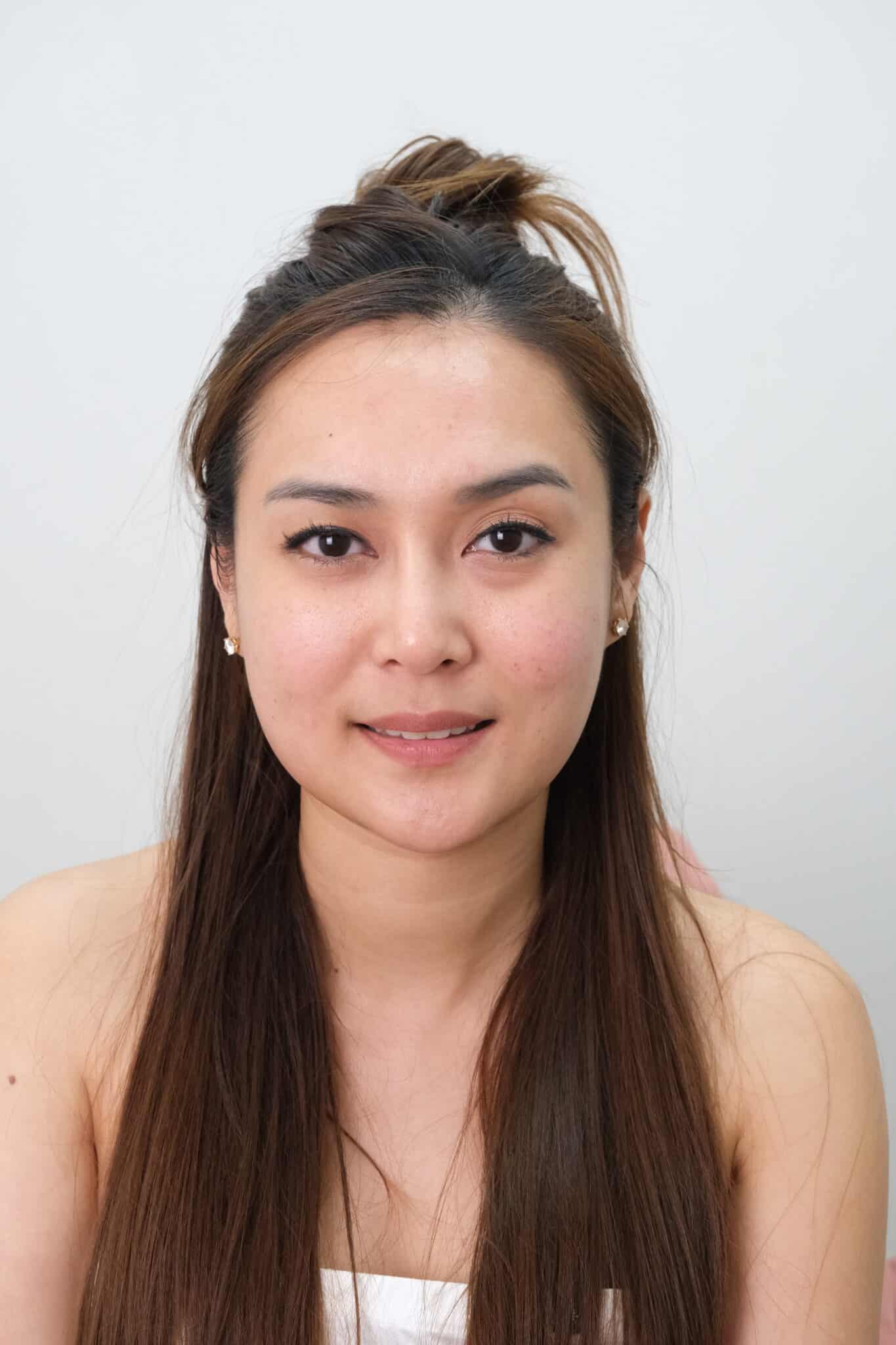 ultraformer เมย์