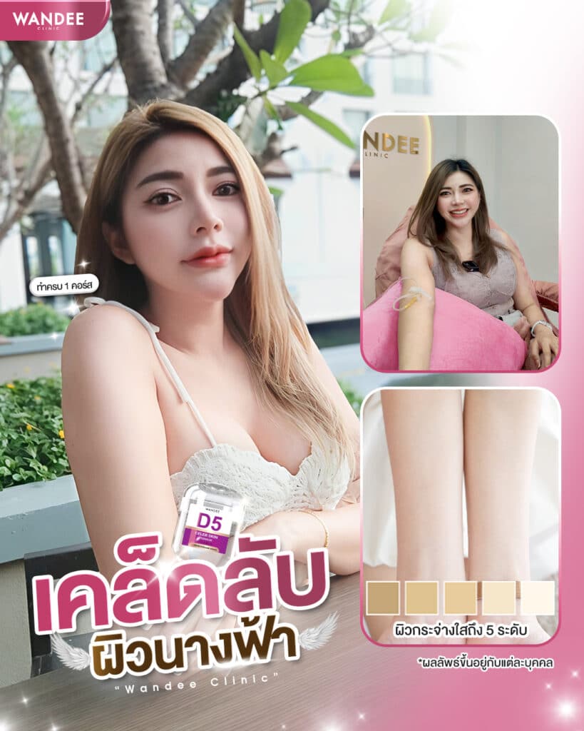 รีวิว ดริปผิว Wandee Clinic