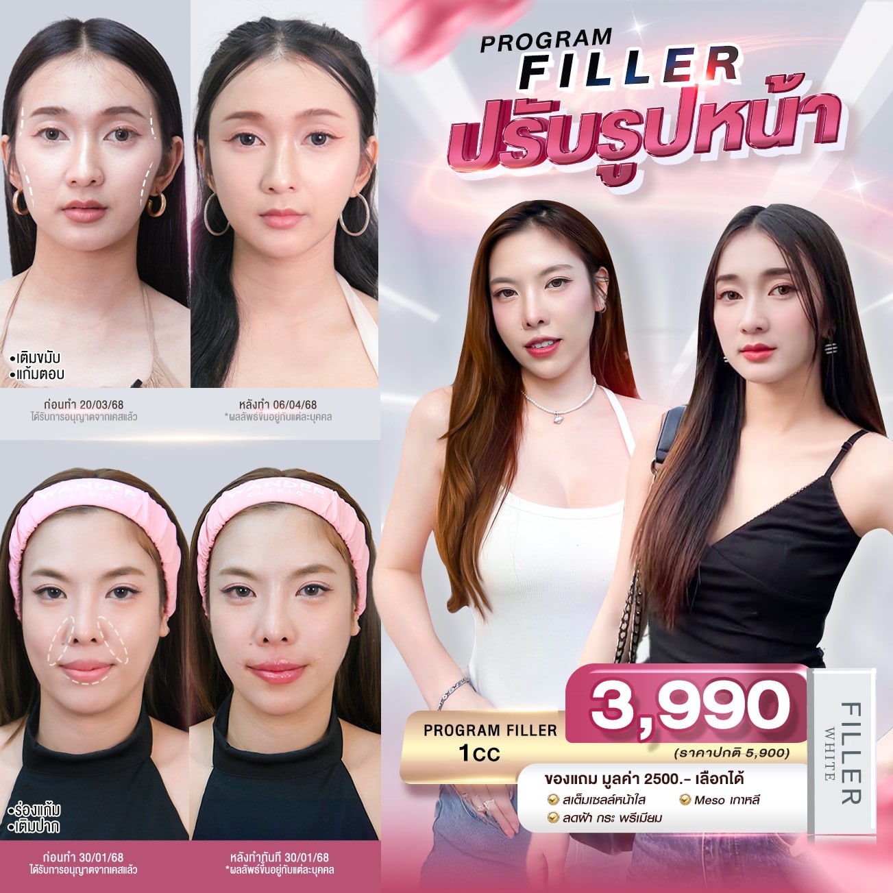 ราคาฟิลเลอร์ Wandee Clinic