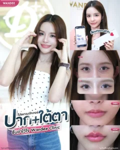 เติม ปาก + ใต้ตา มั่นใจได้เลยว่าหน้าสวยละมุนกว่าเดิม