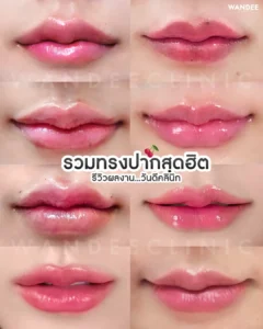 ทรงปากสุดฮิต รวมไว้ที่นี่แล้ว!