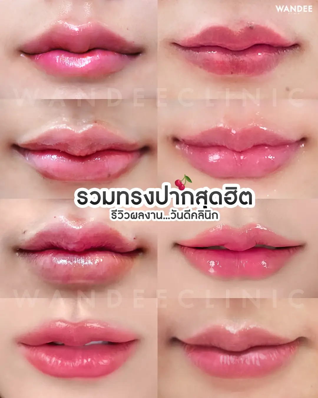 ทรงปากสุดฮิต รวมไว้ที่นี่แล้ว!