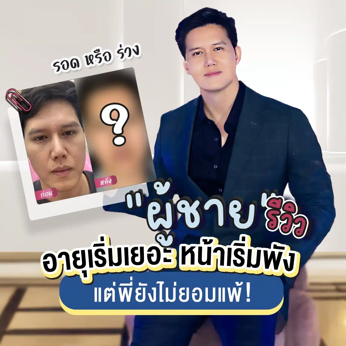 รีวิว Profhilo ที่ Wandee Clinic