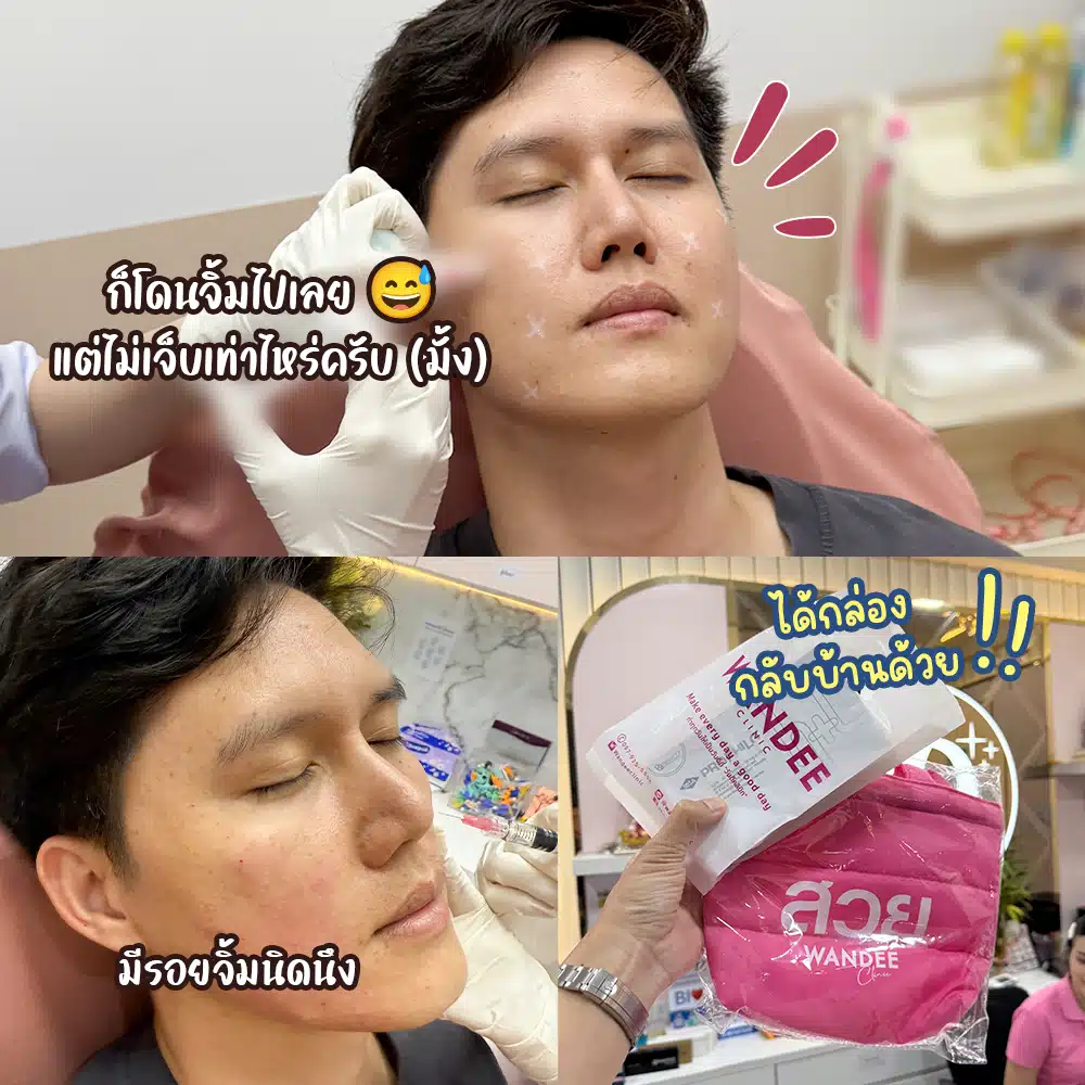 รีวิว Profhilo ที่ Wandee Clinic