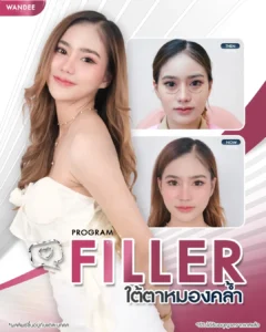 เติมความสดชื่นให้ใบหน้า ด้วยโปรแกรม 𝗙𝗶𝗹𝗹𝗲𝗿