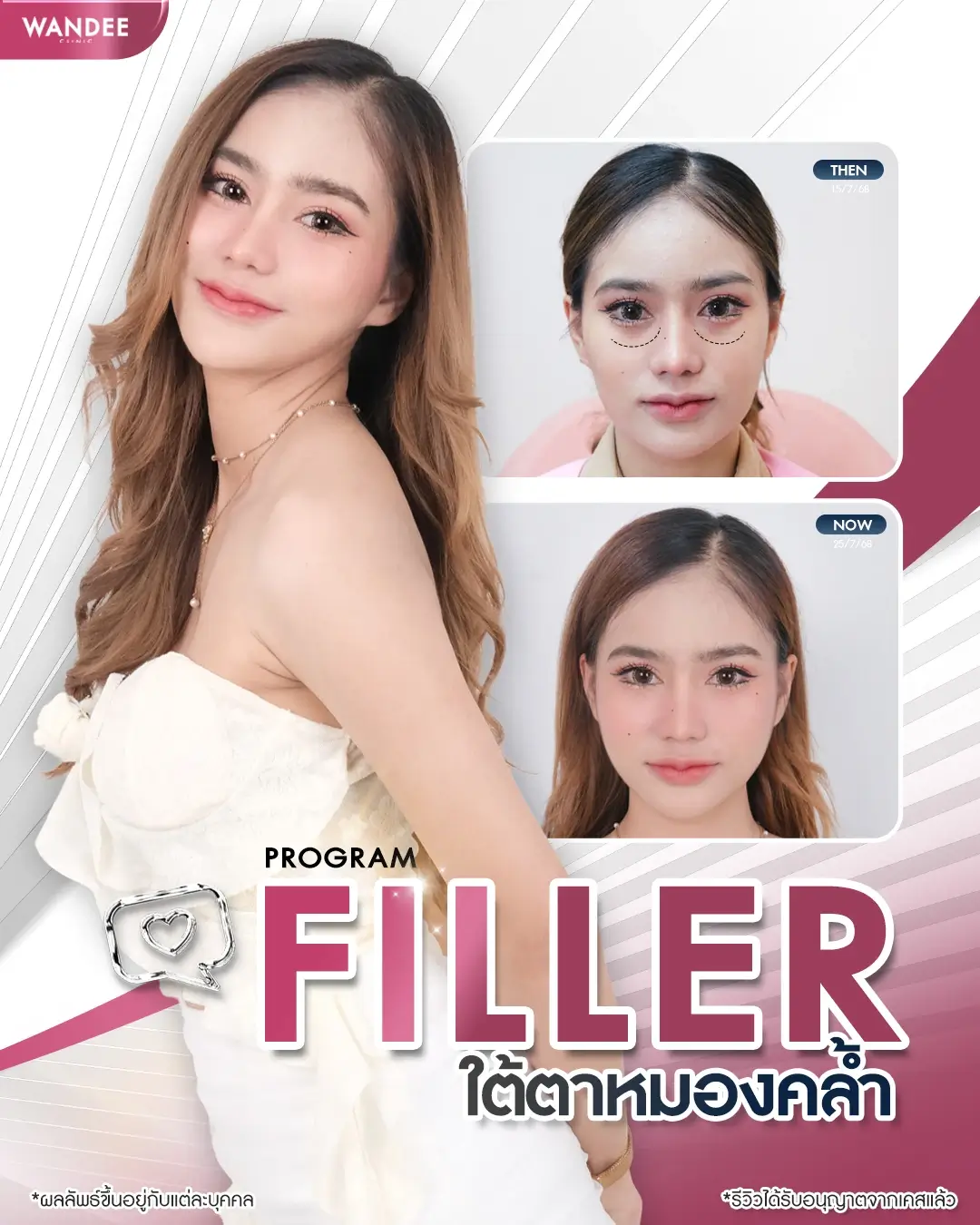 เติมความสดชื่นให้ใบหน้า ด้วยโปรแกรม 𝗙𝗶𝗹𝗹𝗲𝗿