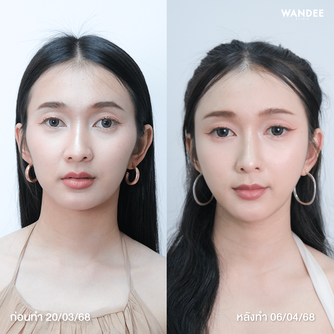 อัปเดท 2 สัปดาห์