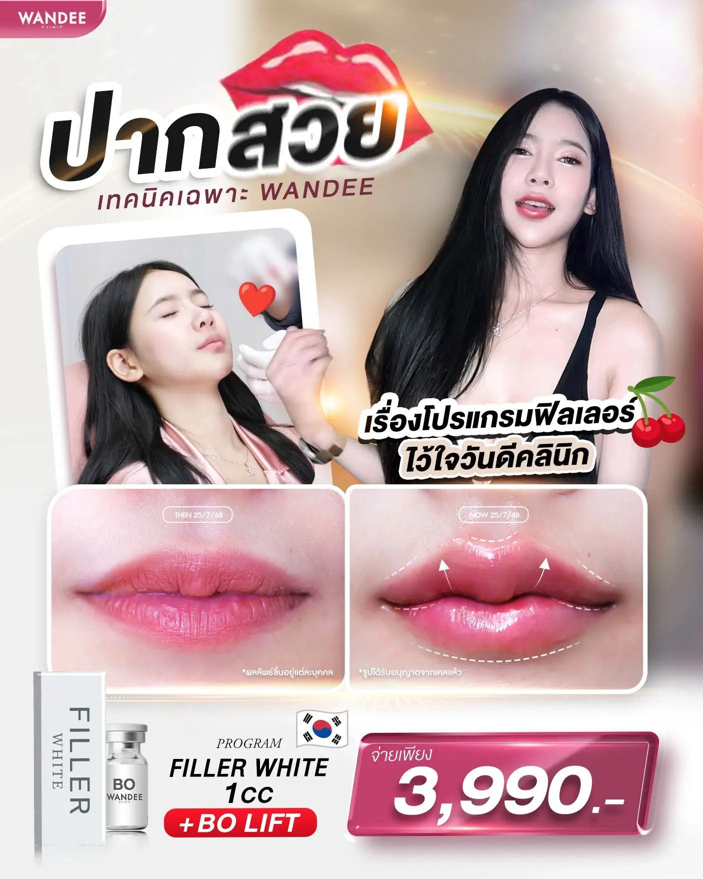 𝗙𝗶𝗹𝗹𝗲𝗿 เติมเสน่ห์ให้ริมฝีปาก ด้วยเทคนิคเฉพาะ