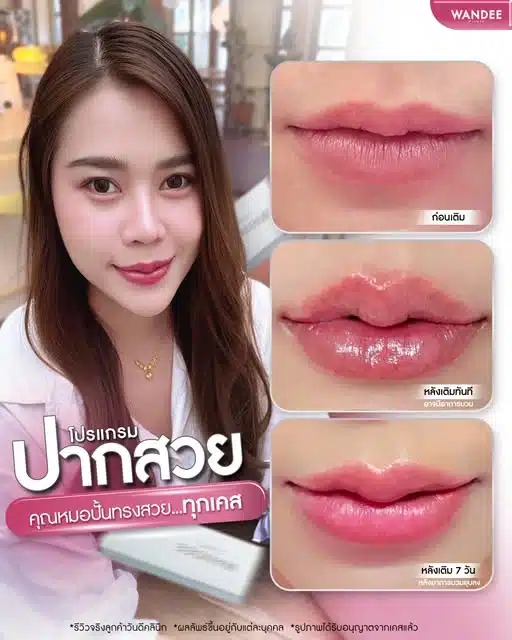 ปากสวยฉ่ำฟู ด้วยโปรแกรม 𝗙𝗶𝗹𝗹𝗲𝗿