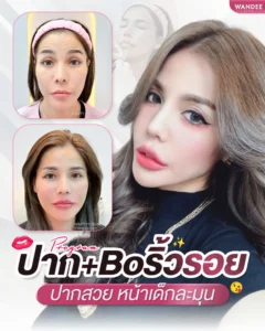 ด้วยโปรแกรม 𝗙𝗶𝗹𝗹𝗲𝗿 ปาก