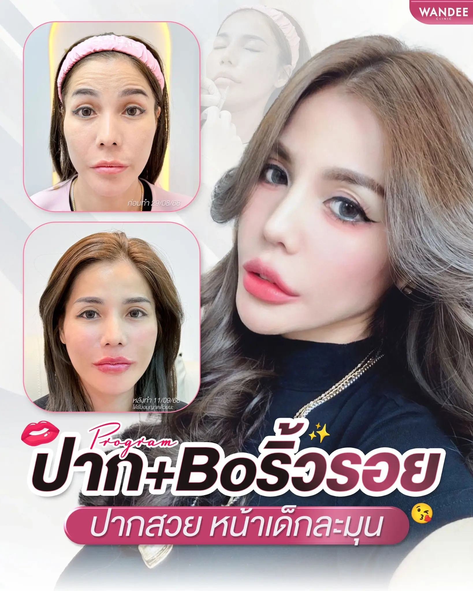 ด้วยโปรแกรม 𝗙𝗶𝗹𝗹𝗲𝗿 ปาก