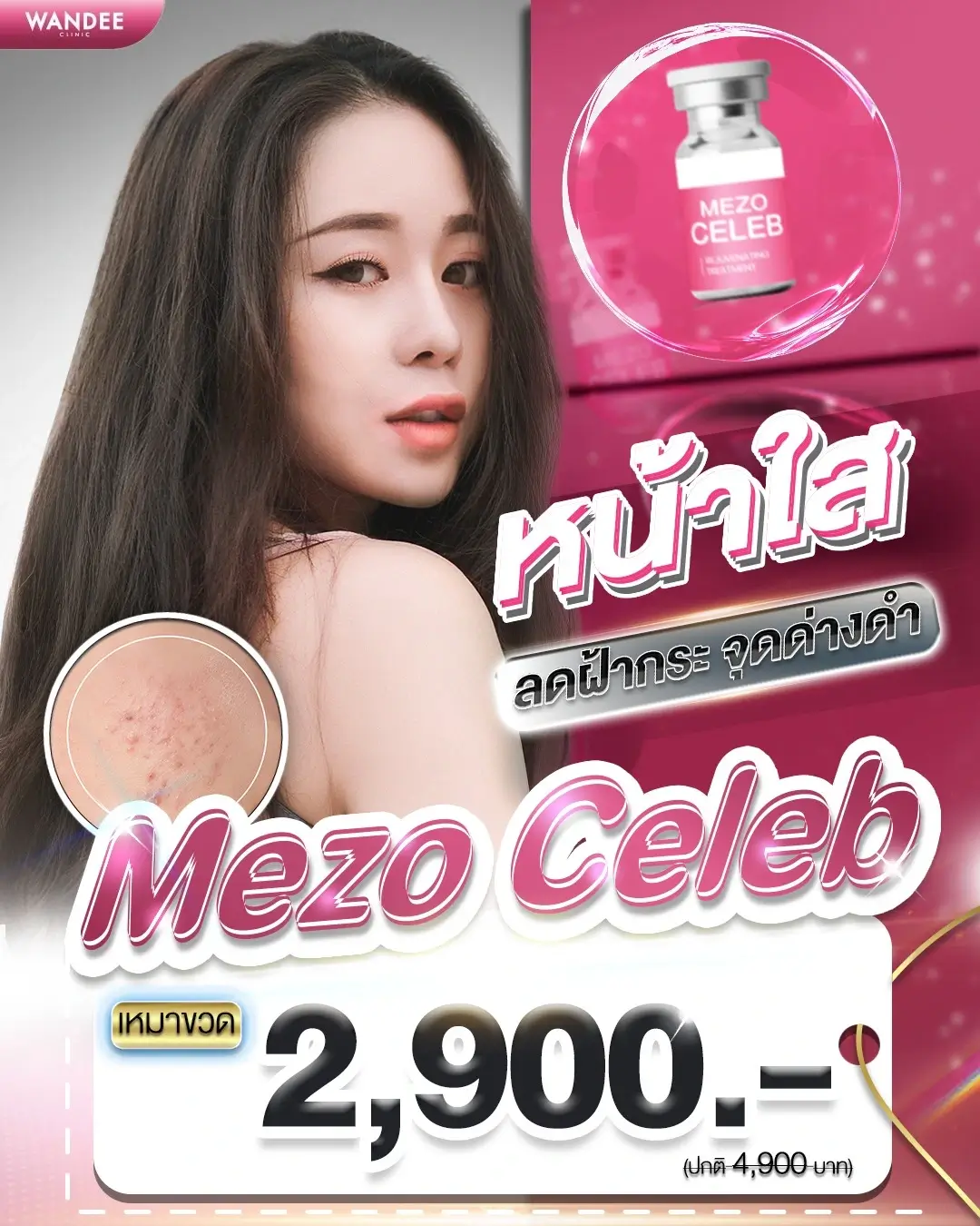 อยากหน้าใสแบบดารา ต้องลองเลย! โปรแกรม 𝗠𝗲𝘇𝗼 𝗖𝗲𝗹𝗲𝗯