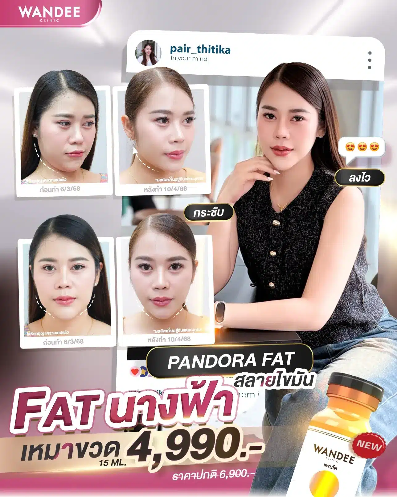 ต้องนี่เลย! โปรแกรม 𝗙𝗮𝘁 นางฟ้า 𝗣𝗮𝗻𝗱𝗼𝗿𝗮 𝗙𝗮𝘁