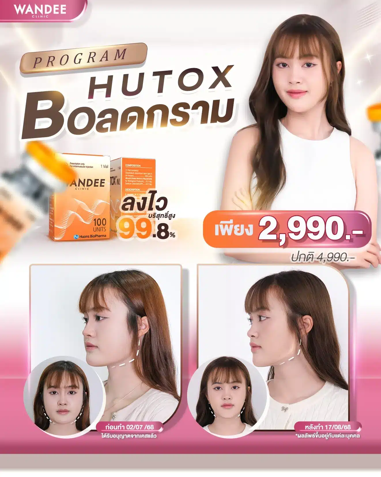 กรามหาย หน้าเรียวไว