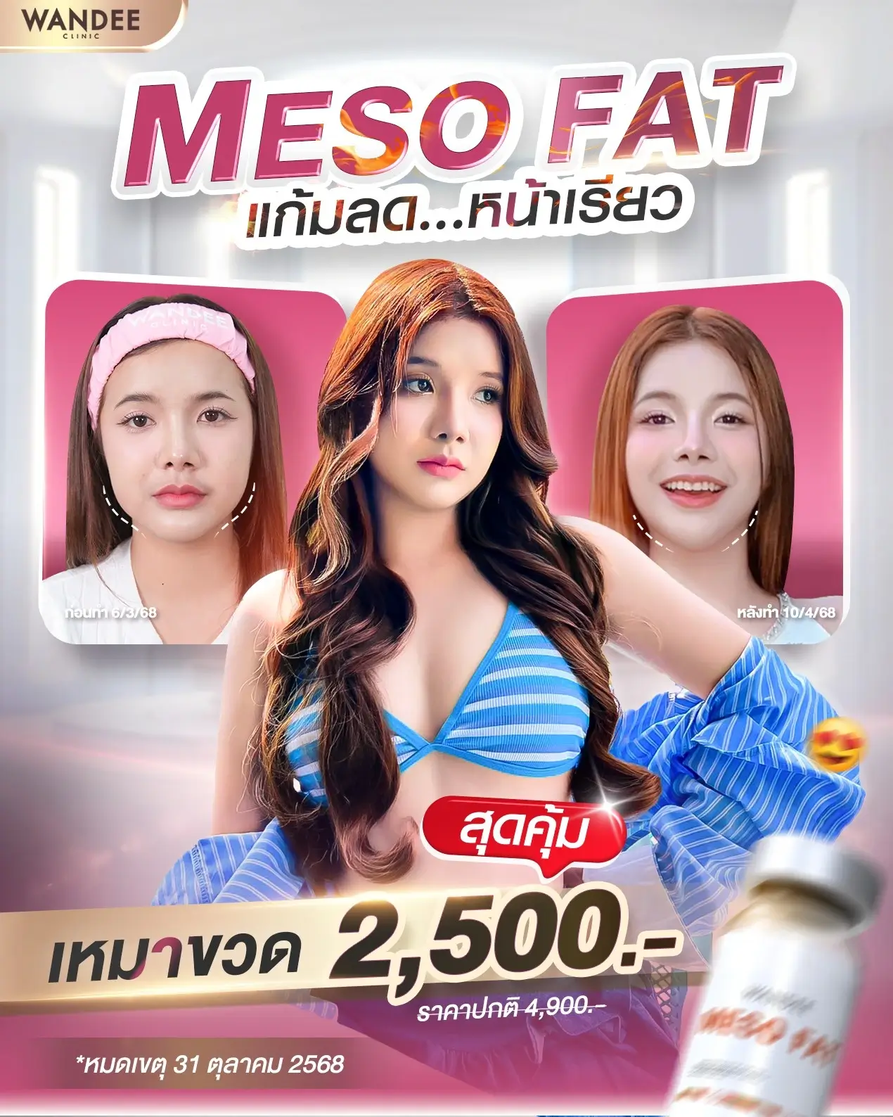 โปรแกรม 𝙈𝙚𝙨𝙤 𝑭𝒂𝒕 เหมาขวด คุ้มกว่านี้ไม่มีแล้ว รีบจองด่วน