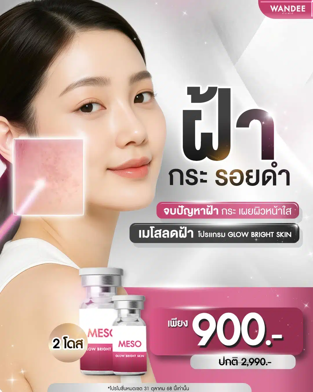 ลดฝ้า กระ รอยดำ หน้าไบร์ทขึ้น เพียง 𝟵𝟬𝟬.-