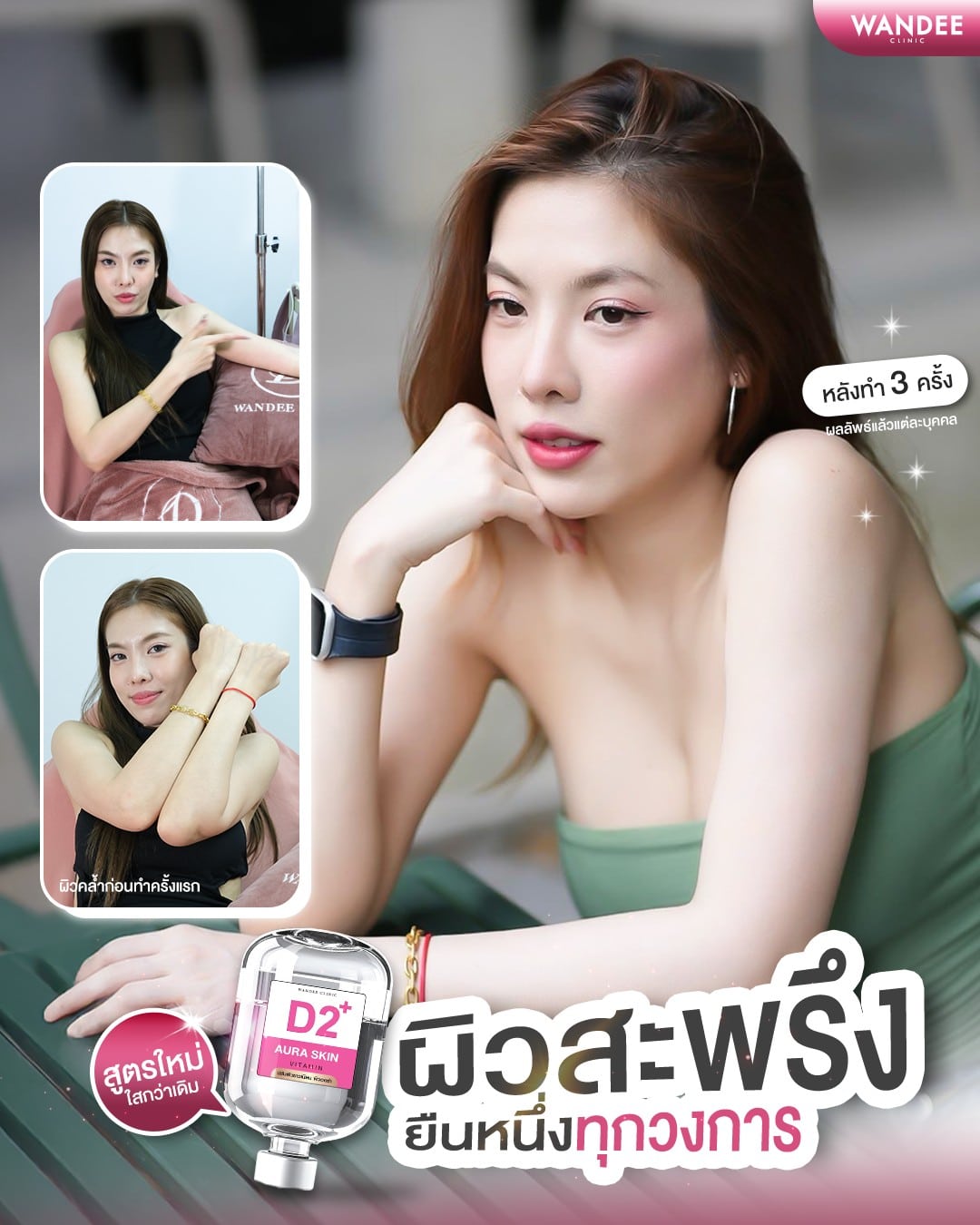 รีวิวดริปผิว