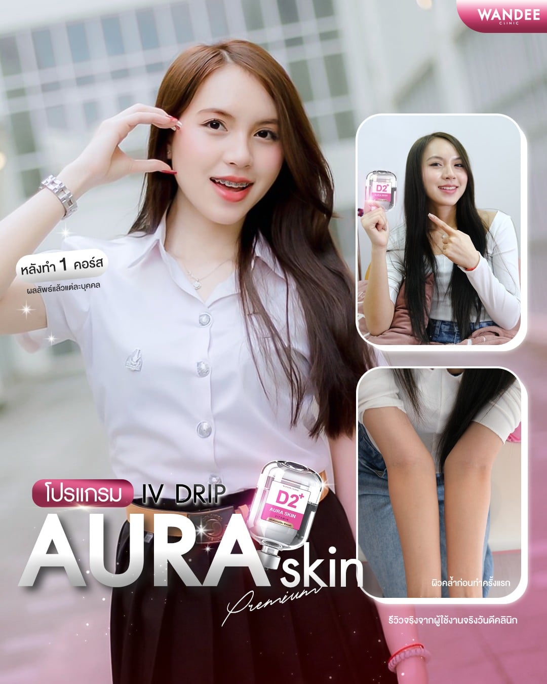 รีวิวดริปผิว