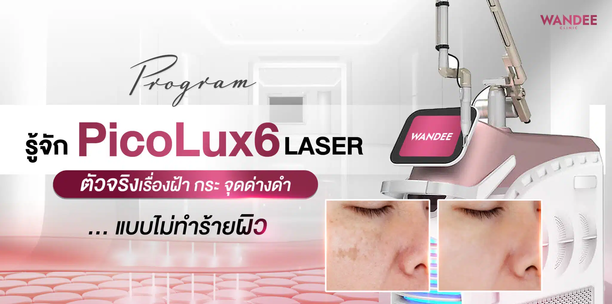 Picolux6