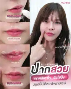 ฟิลเลอร์ปาก