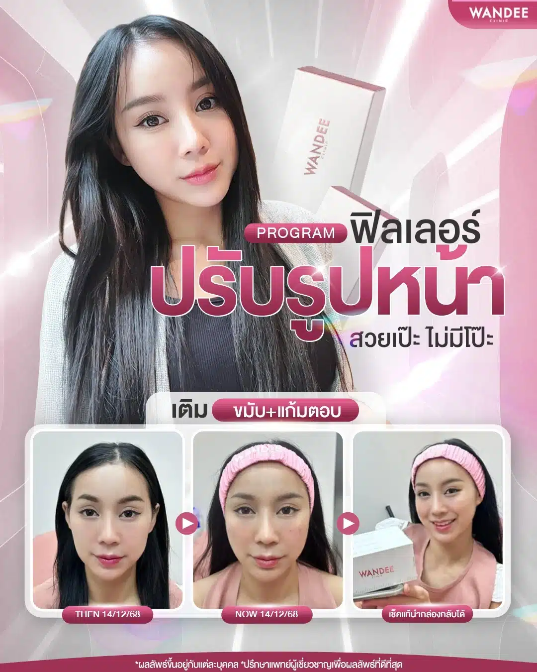 ฉีดฟิลเลอร์ปรับรูปหน้า จากวันดีคลินิก