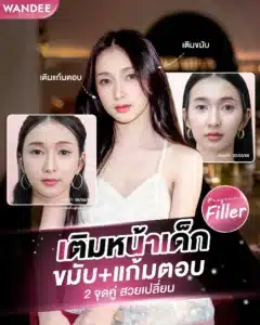 ฉีดฟิลเลอร์เติมหน้าเด็ก