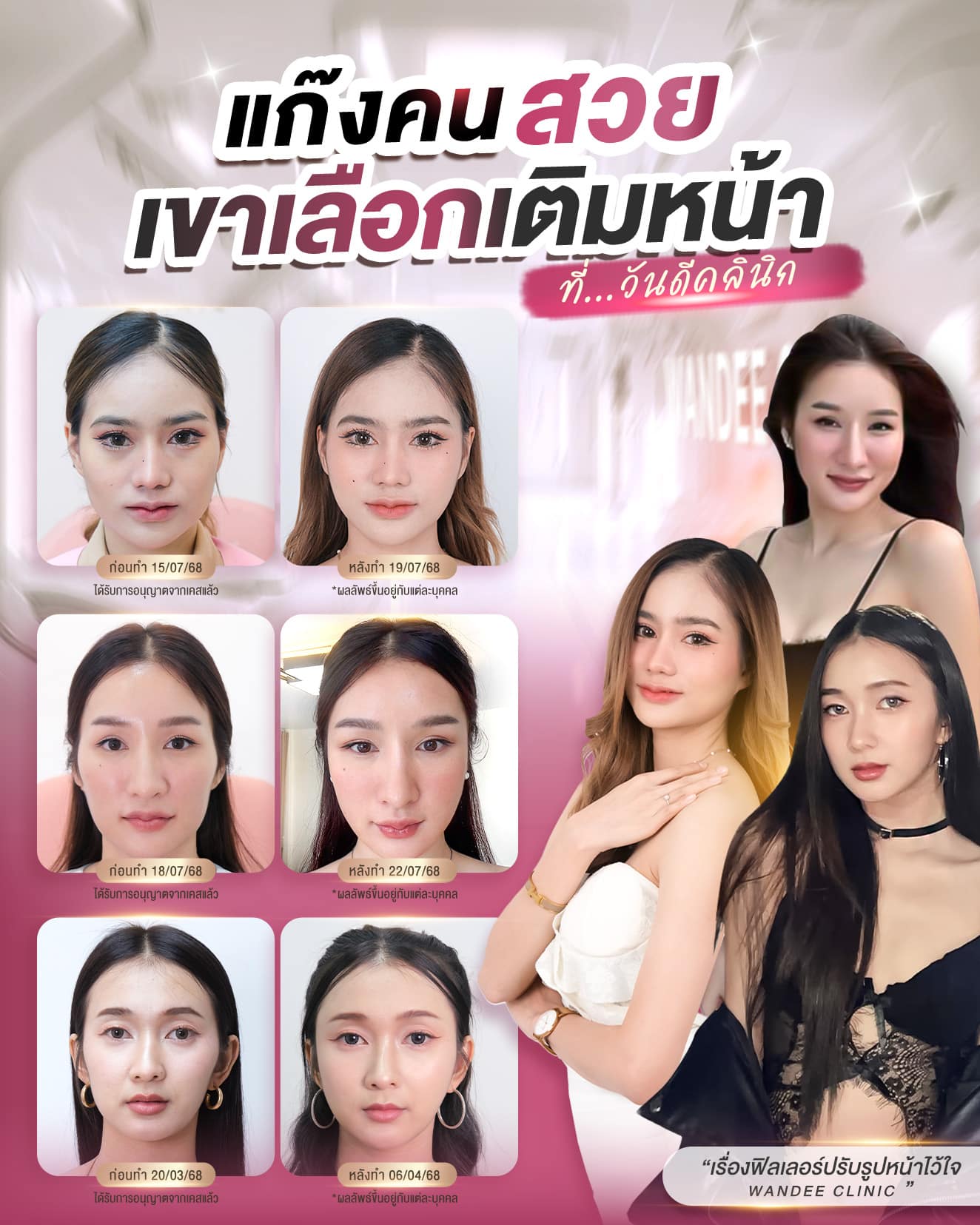 ฟิลเลอร์