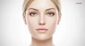 ภาพ 3D medical แสดงโครงสร้างกระดูกและชั้นเนื้อเยื่อบริเวณคาง ขมับ และกรอบหน้า เพื่ออธิบายตำแหน่งการวางฟิลเลอร์