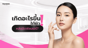 ภาพปกบทความอธิบายกลไกการอุ้มน้ำของฟิลเลอร์ Hyaluronic Acid (HA) และการเปลี่ยนแปลงของผิวหลังฉีดในช่วงแรก