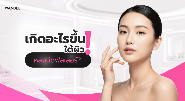ภาพปกบทความอธิบายกลไกการอุ้มน้ำของฟิลเลอร์ Hyaluronic Acid (HA) และการเปลี่ยนแปลงของผิวหลังฉีดในช่วงแรก