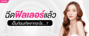 ฉีดฟิลเลอร์แล้วเป็นก้อน เกิดจากอะไร? วิธีป้องกันและแก้ไขโดยแพทย์คลินิกความงาม