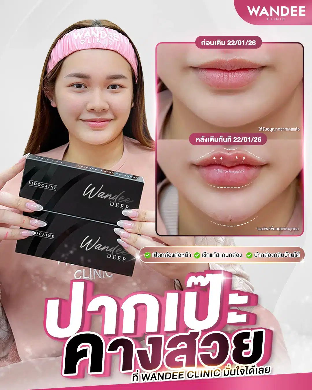 Thin lips, short chin