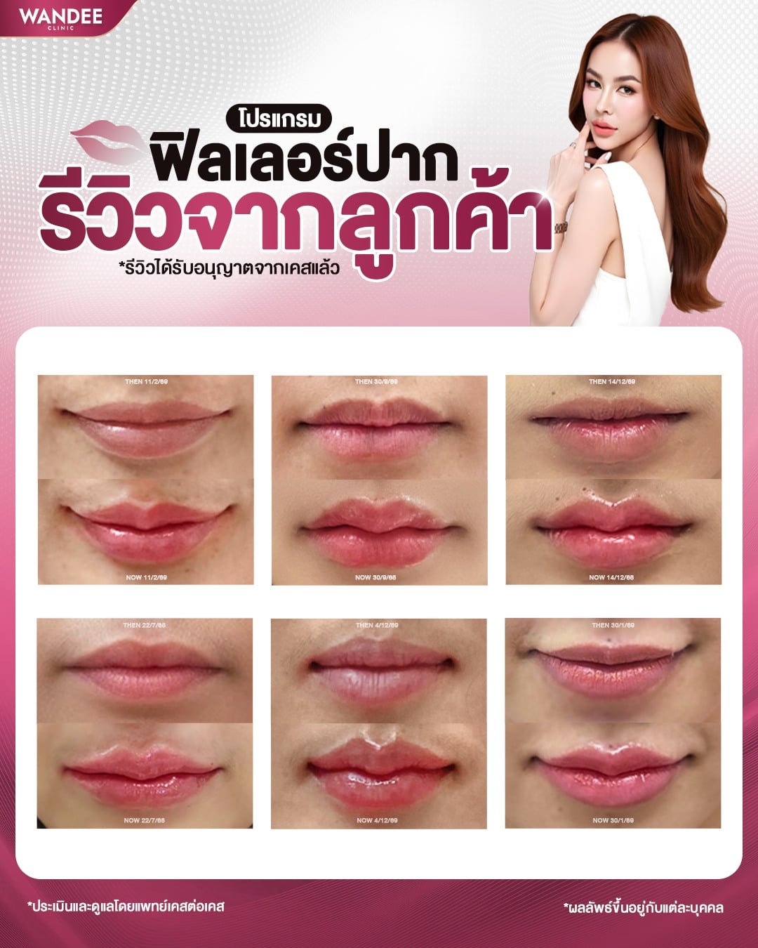 Compilation of reviews for Program Filler lip product