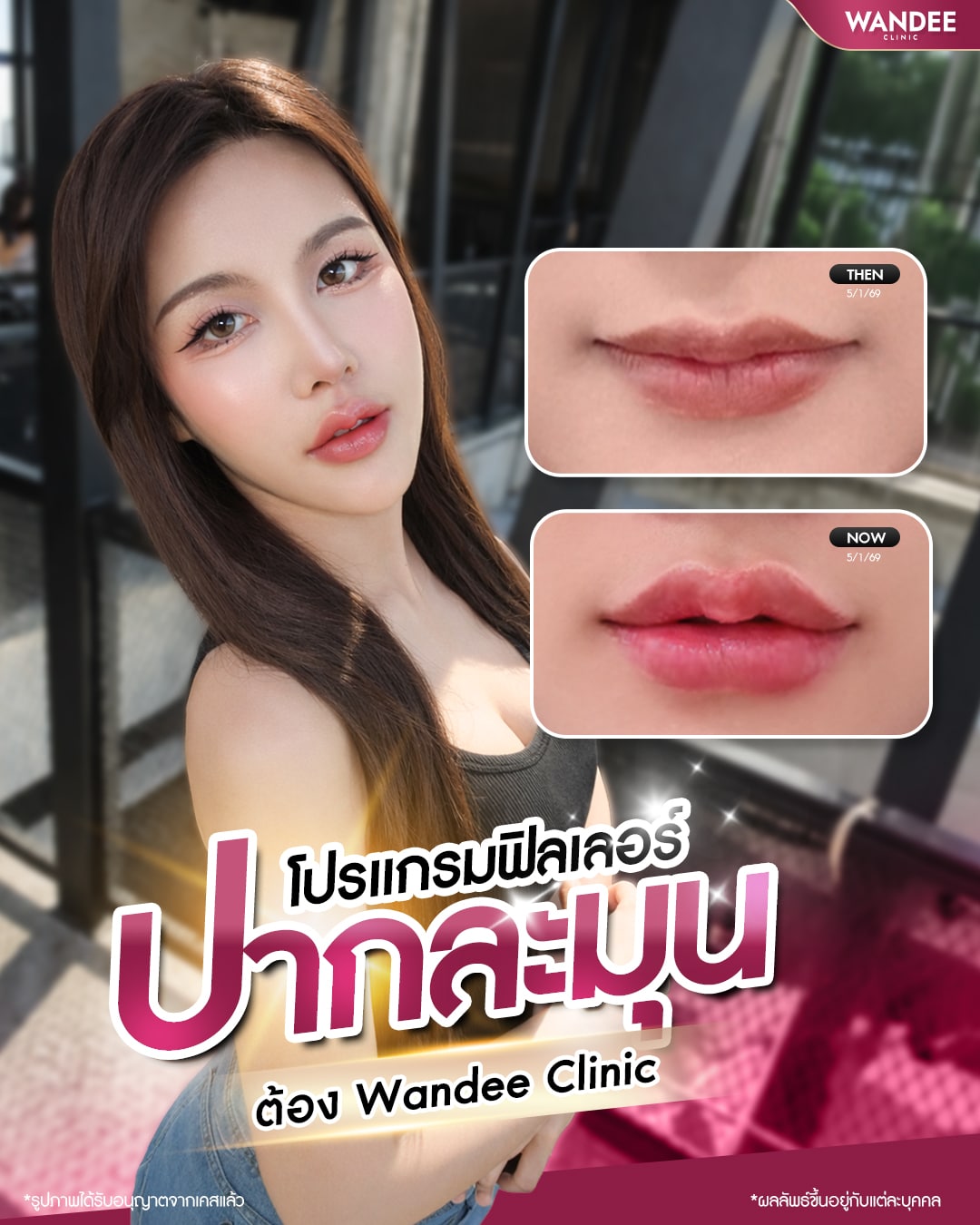 ปากบาง ไม่เป็นทรง