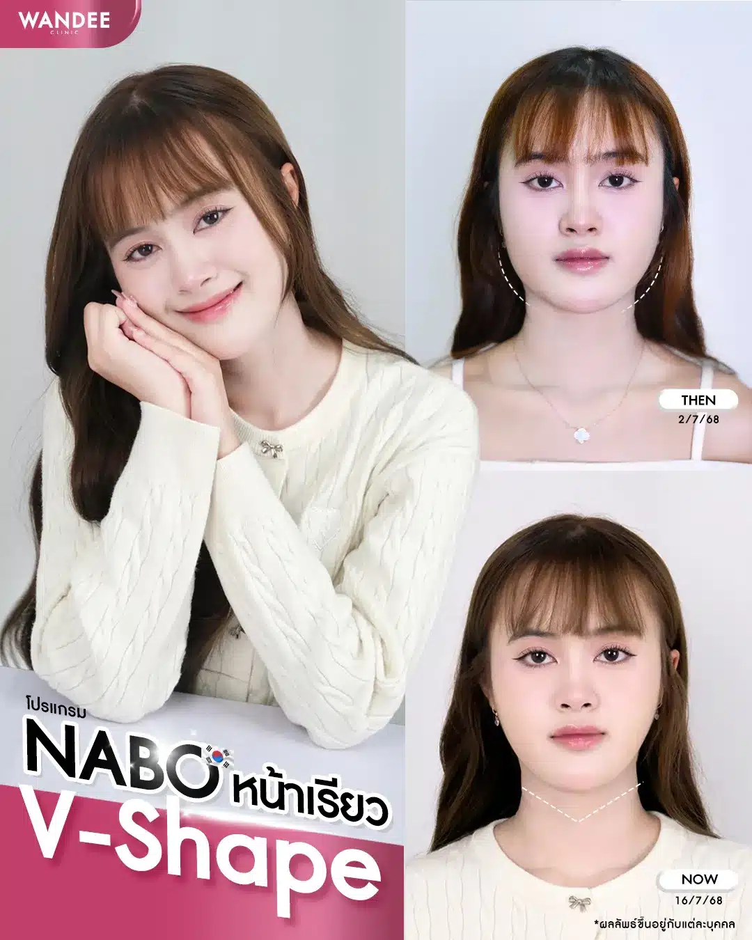 รีวิว nabota Wandee clinic