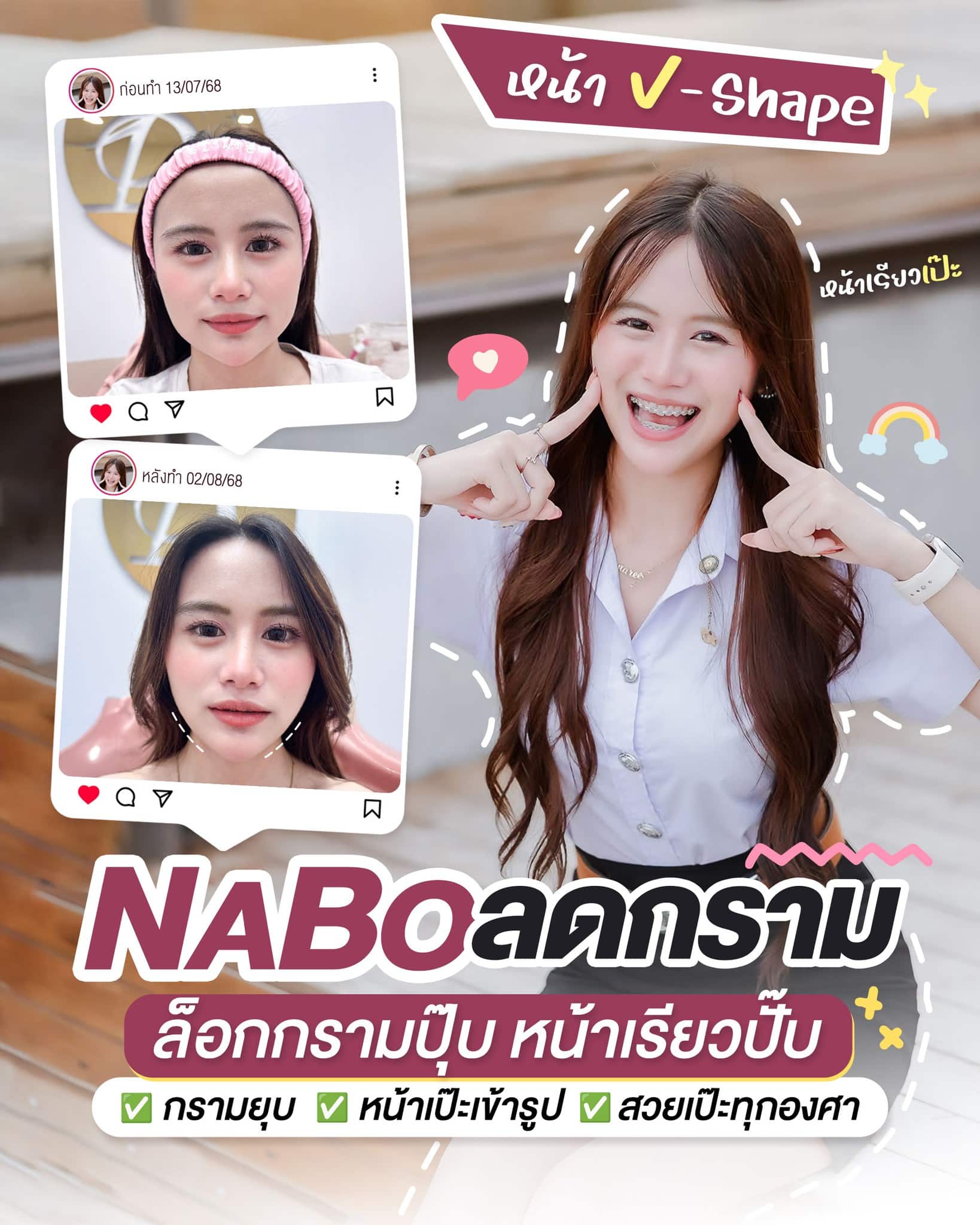 รีวิวโบท็อกซ์