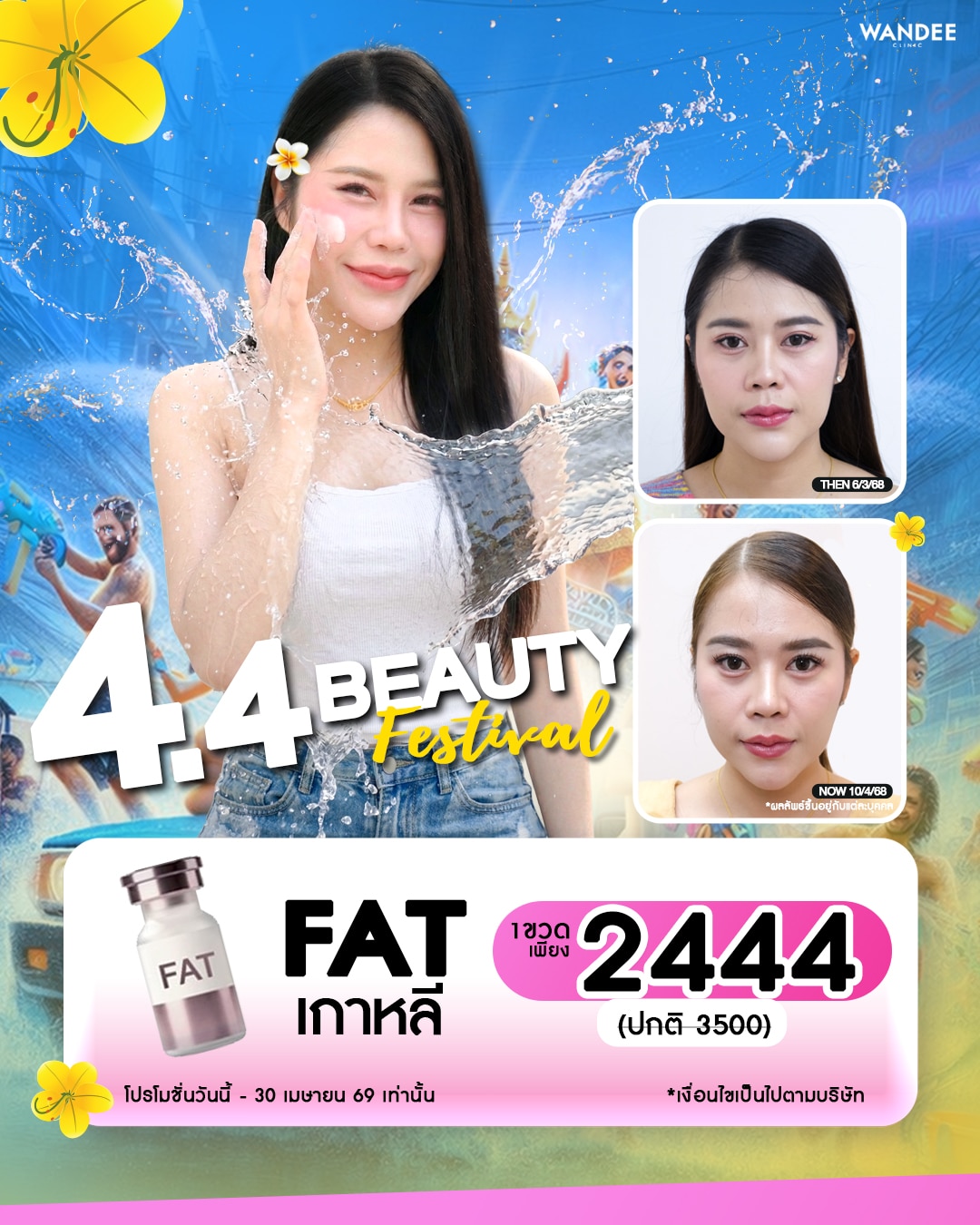 หน้าบวมไม่ไหว