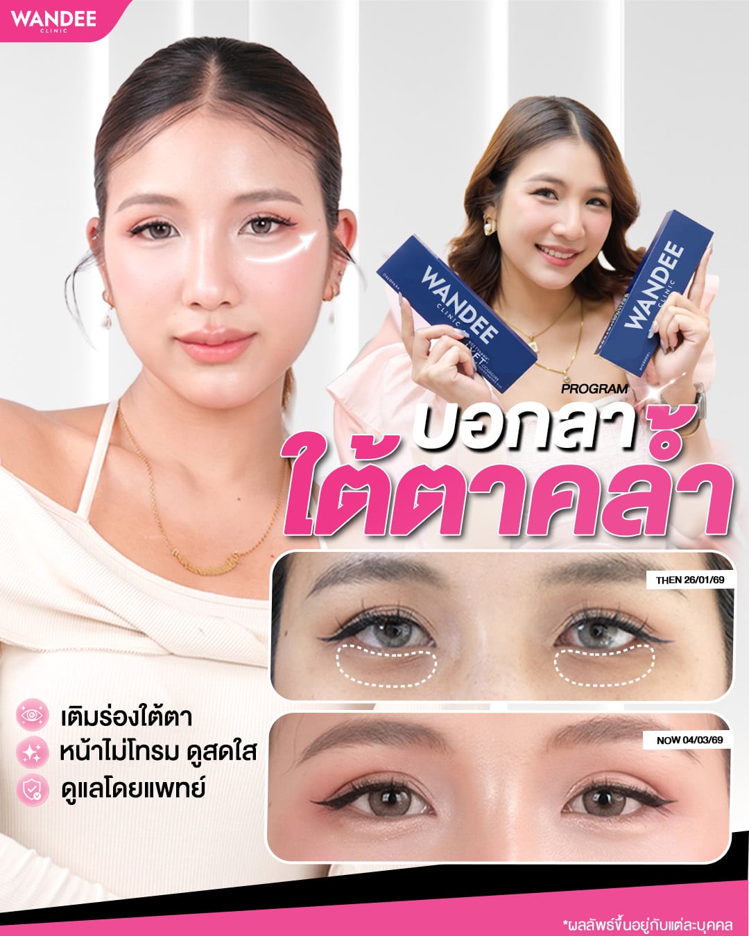 บอกลาใต้ตาคล้ำ หน้าเหนื่อยล้า