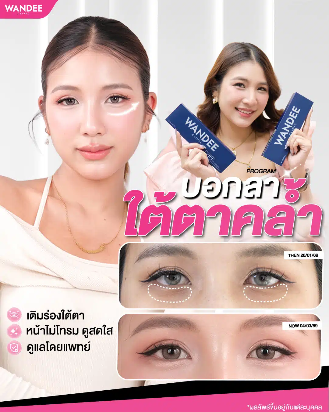 บอกลาใต้ตาคล้ำ หน้าเหนื่อยล้า