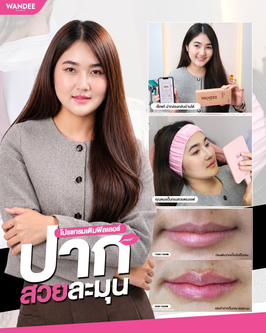 เติมปากเทคนิคพิเศษ