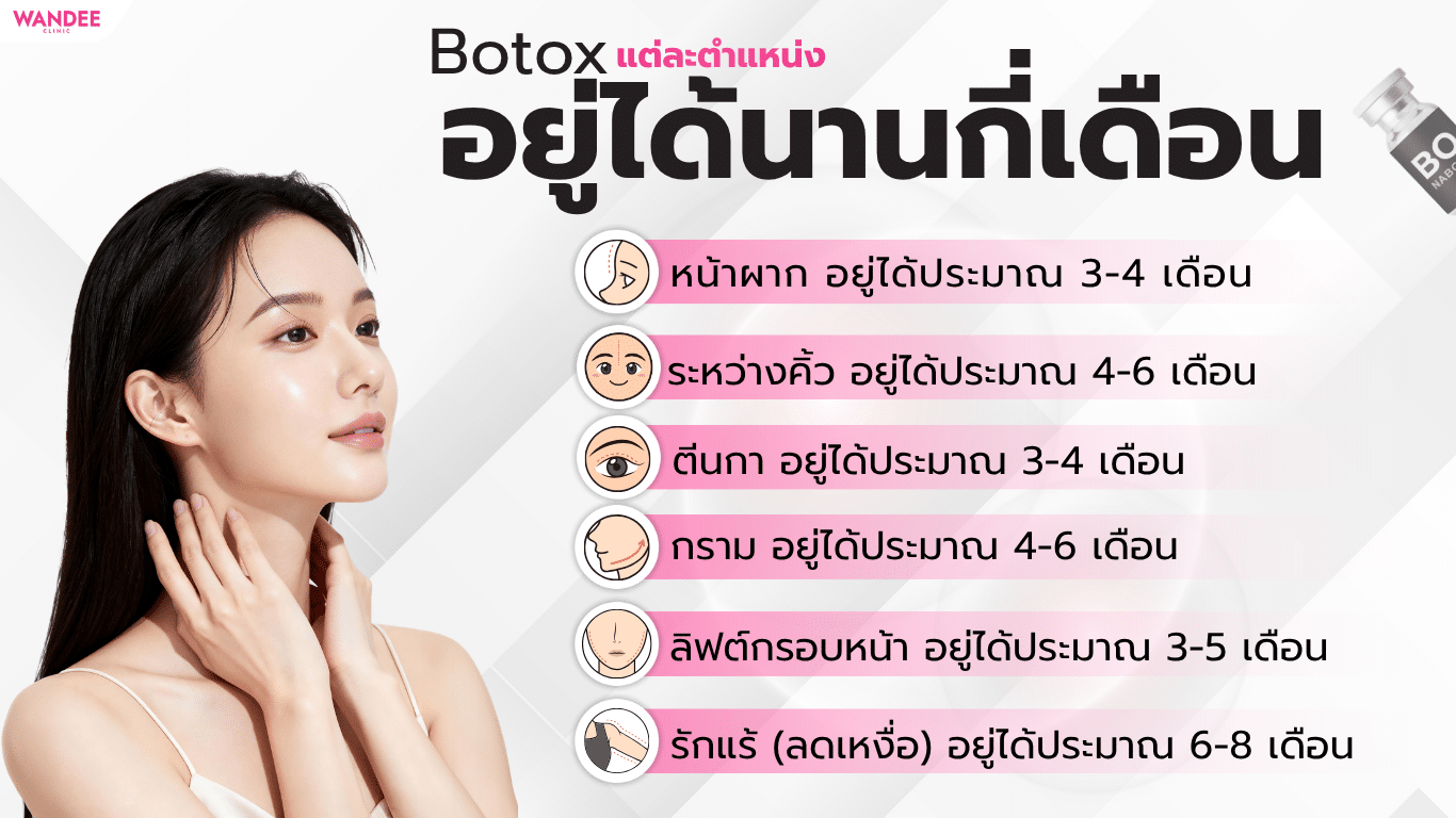 โบท็อกซ์อยู่ได้นานกี่เดือนตามตำแหน่งยอดนิยม