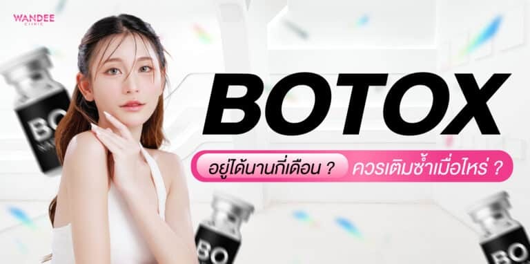 โบท็อกซ์อยู่ได้นานกี่เดือน ? ขึ้นกับอะไร และควรเติมซ้ำเมื่อไหร่
