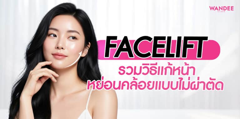 Facelift ยกกระชับหน้า คืออะไร? รวมวิธีแก้หน้าหย่อนคล้อยแบบไม่ผ่าตัด