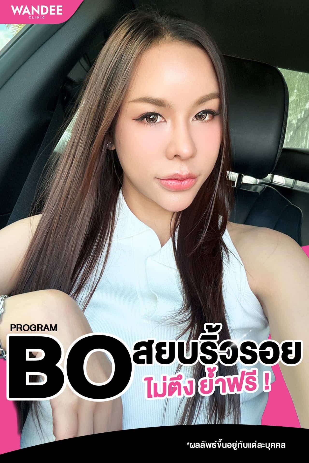 หน้าผากย่น หว่างคิ้วชัด หางตาเริ่มมา