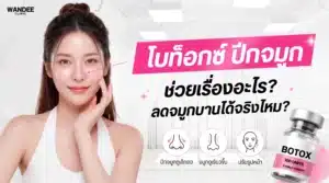 โบท็อกซ์ปีกจมูกช่วยลดปีกจมูกบานขณะยิ้ม